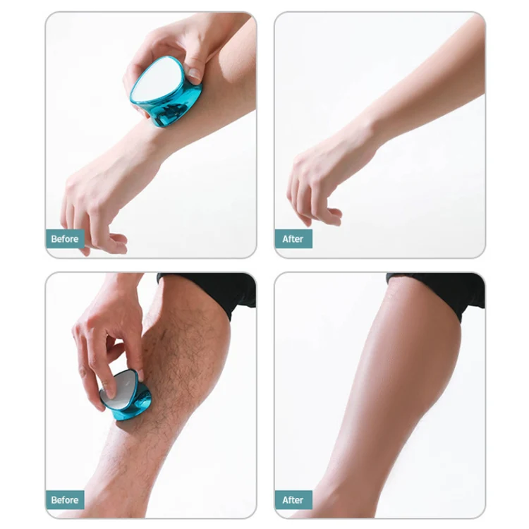 2 In 1 Hair Removal Foot Grinder Foot Peeling Pedicure Tool Epilator(Gold) - Image 11