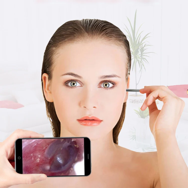 A1 WiFi Endoscope Camera 720P Ear Cleaning Wireless Safe Ear Pick Tool Visual Ear Spoon, Diameter: 3.9mm(White) - Image 8