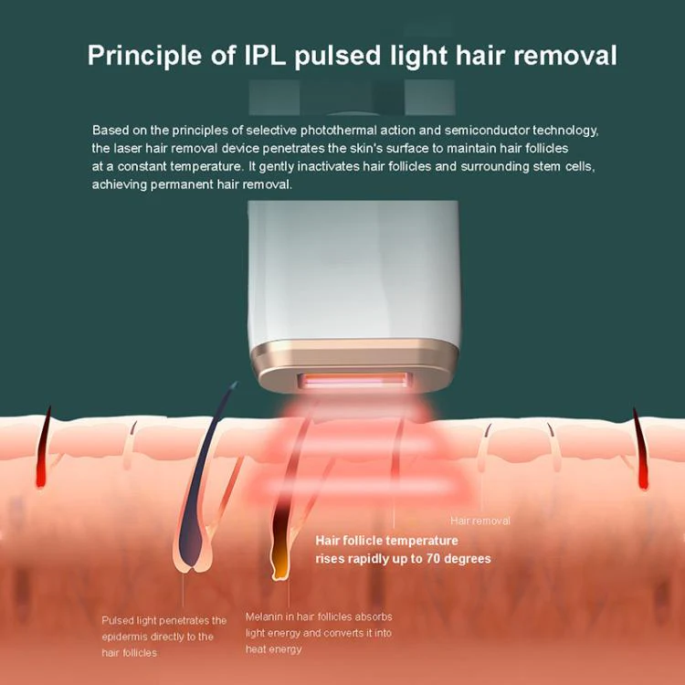 AI09 IPL Electric Hair Removal Device, Plug Type:EU Plug(White) - Image 6