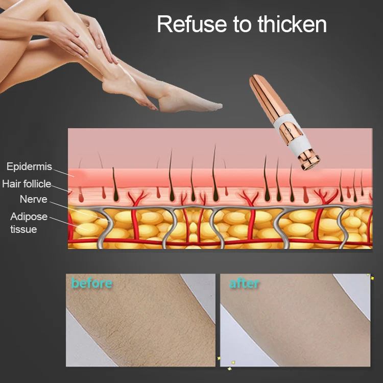 Alecoy Ladies Lipstick-type Electric Epilator - Image 9
