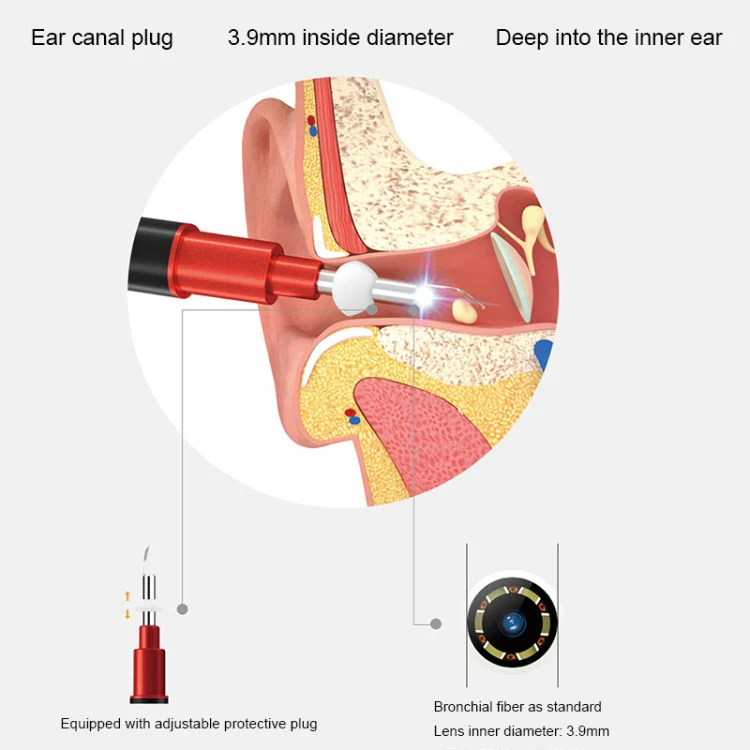 Bebird B1 Intelligent HD Visual Ear Cleaner Earwax Tool, Standard Version(Black) - Image 10