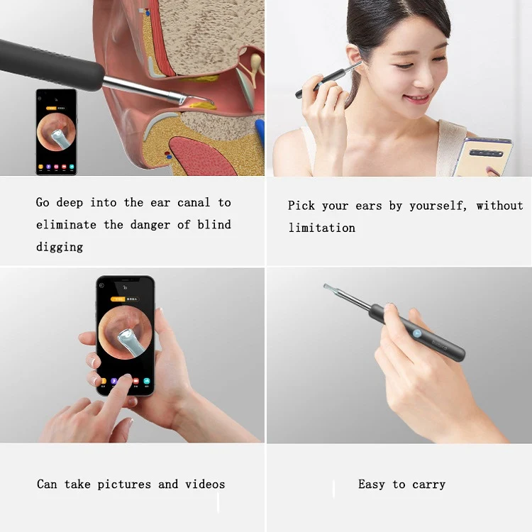 Bebird R1 High-Definition Endoscope Luminous Visual Ear Picking Tool(R1-Classic Black) - Image 6