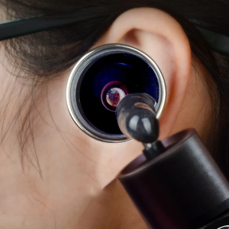 Ear Cleaning Hand Lamp USB Charging Otoscope(Black) - Image 7