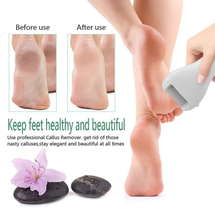 Electric Foot Grinder Digital Display USB Pedicure Peeling(Gold) - Image 6