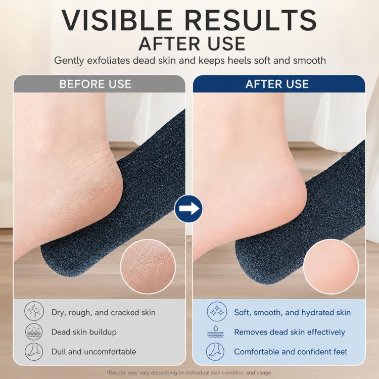 Foot File Callus Remover For Feet  5-Sided Silicon Carbide Pumice Stone With Ergonomic Bamboo Handle(Black) - Image 5