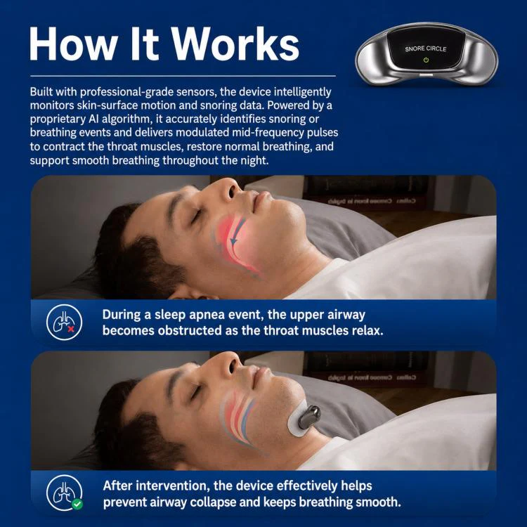 SNORE CIRCLE Smart Anti-Snoring Device Upgraded TENS & EMA Throat Snore Stopper With 3-Contact Electrode & App Tracking(Silver) - Image 4