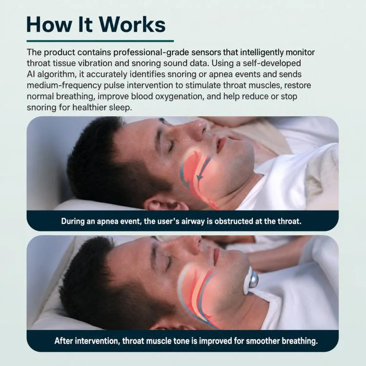 SNORE CIRCLE Smart Anti-Snoring Device Wearable TENS & EMA Throat Snore Stopper With App Tracking Sleep Aid For Adults(Green) - Image 4