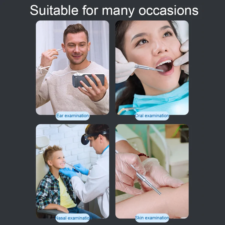 TESLONG MS450 4.5 inch HD Smart Screen Otoscope with 32GB Memory Card - Image 6