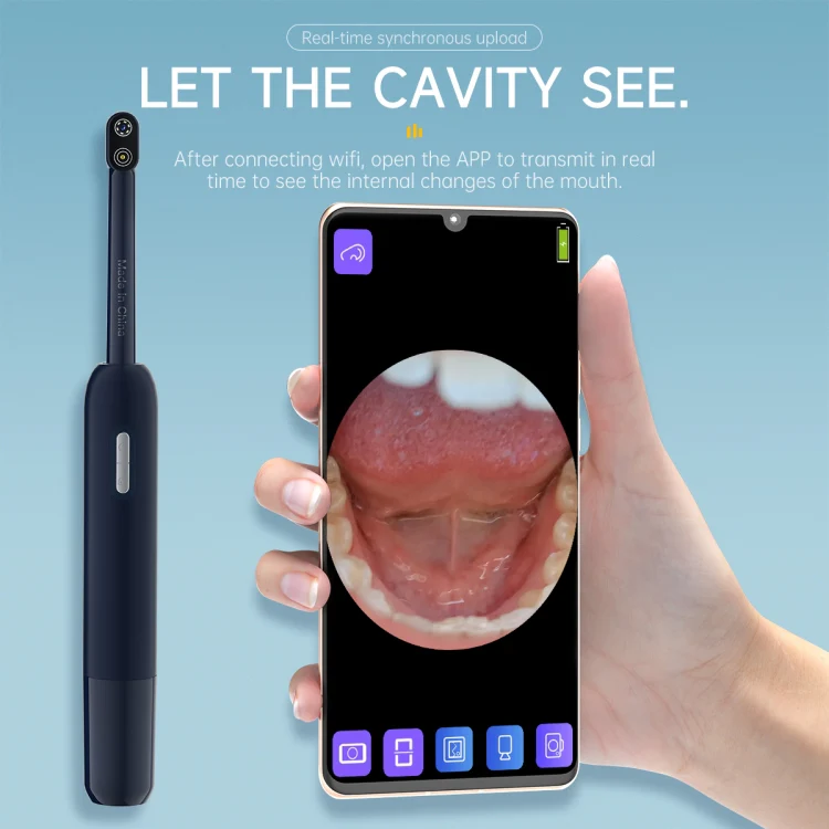 Z70 7 LEDs 5.0MP Wifi Visible Oral Endoscope(Dark Blue) - Image 4